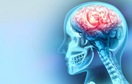 Human brain injury